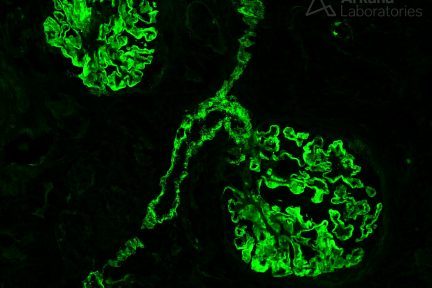 Vascular Staining in Membranous