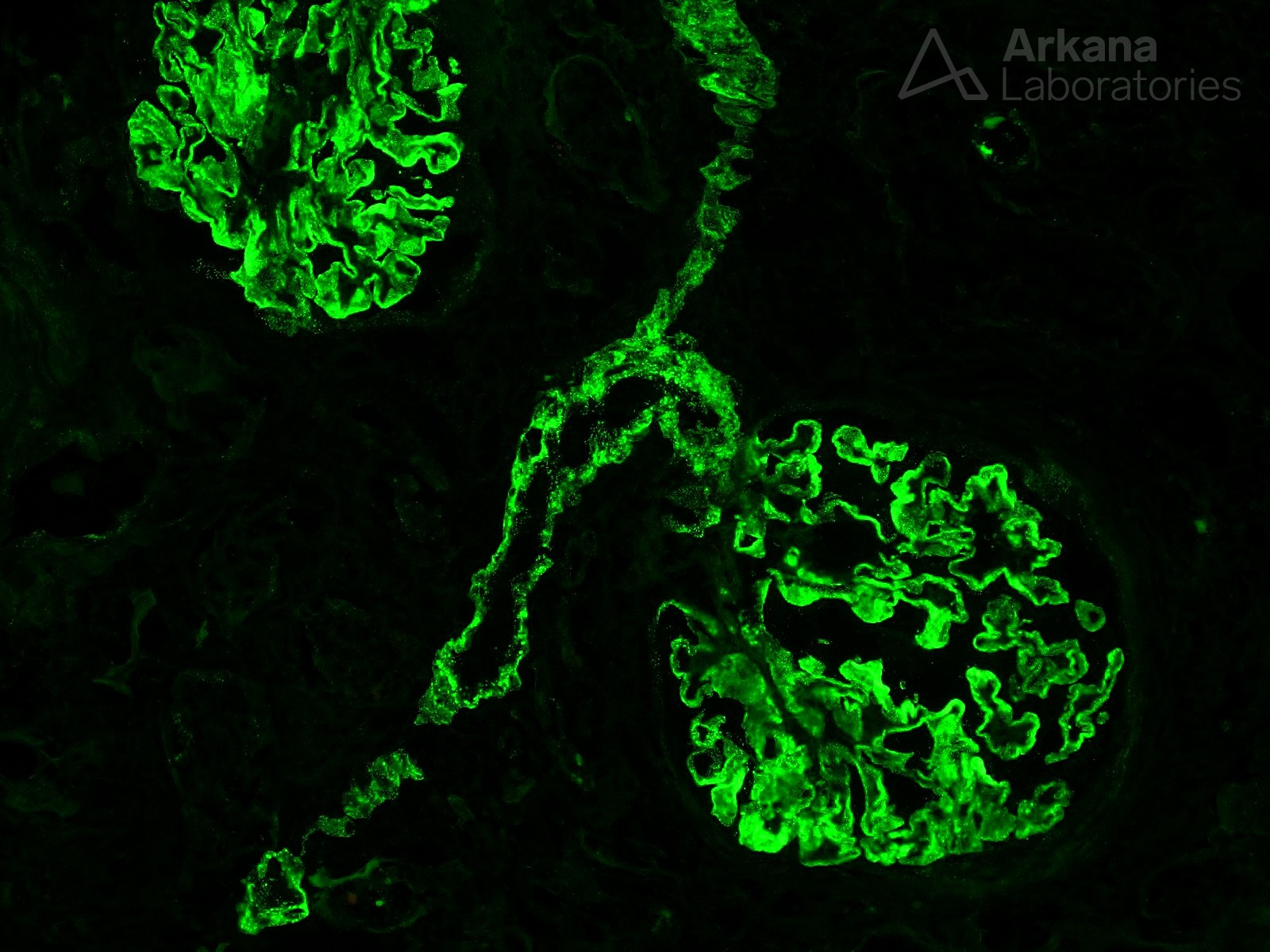 Vascular Staining in Membranous