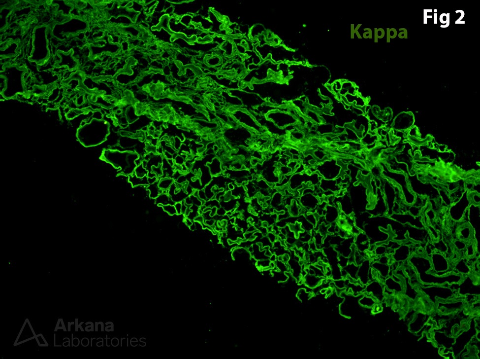 Peritubular Giant Cells