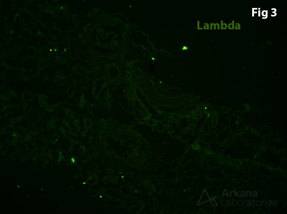 Peritubular Giant Cells