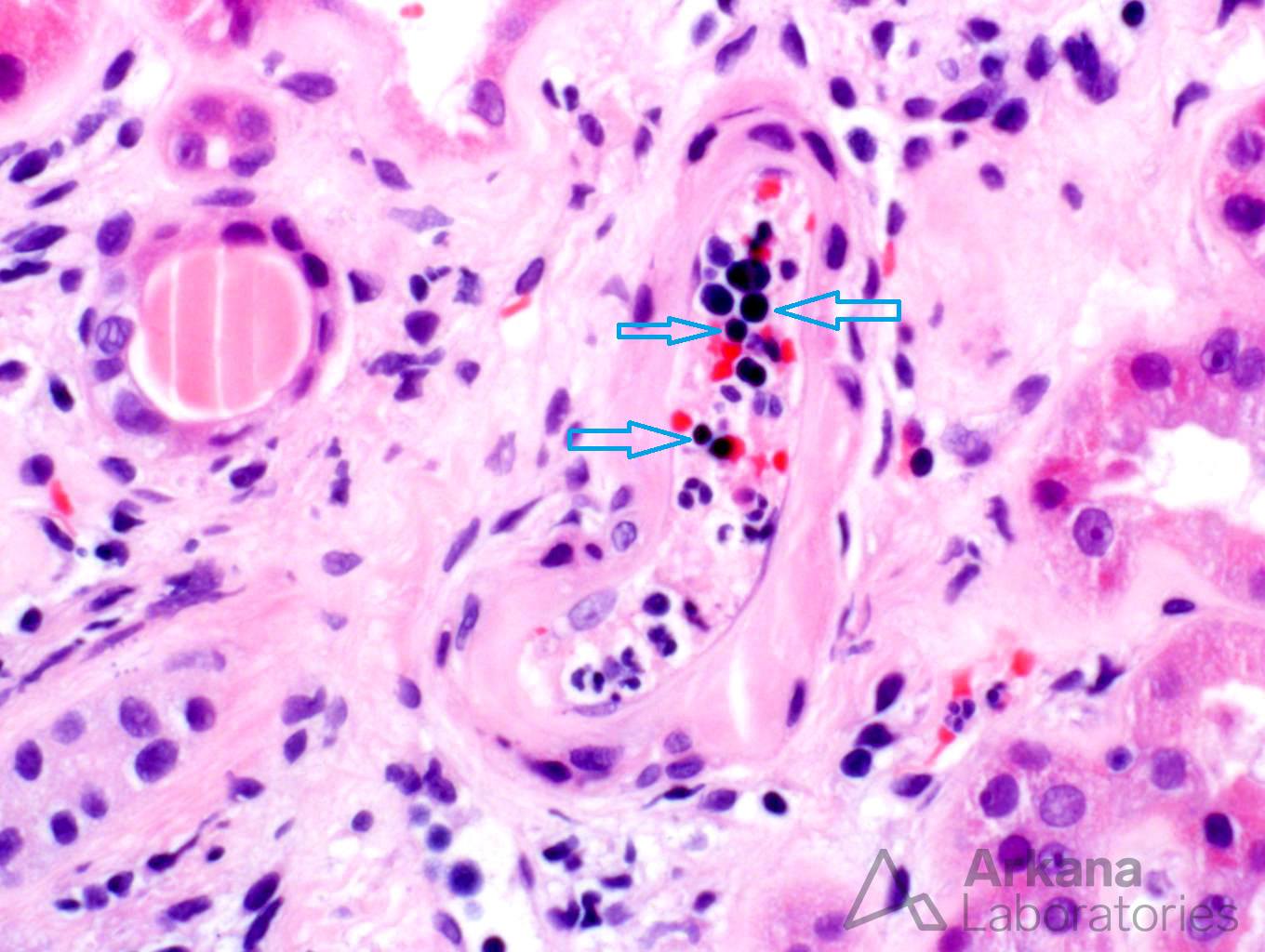 Nucleated Red Blood, teaching point, arkana laboratories