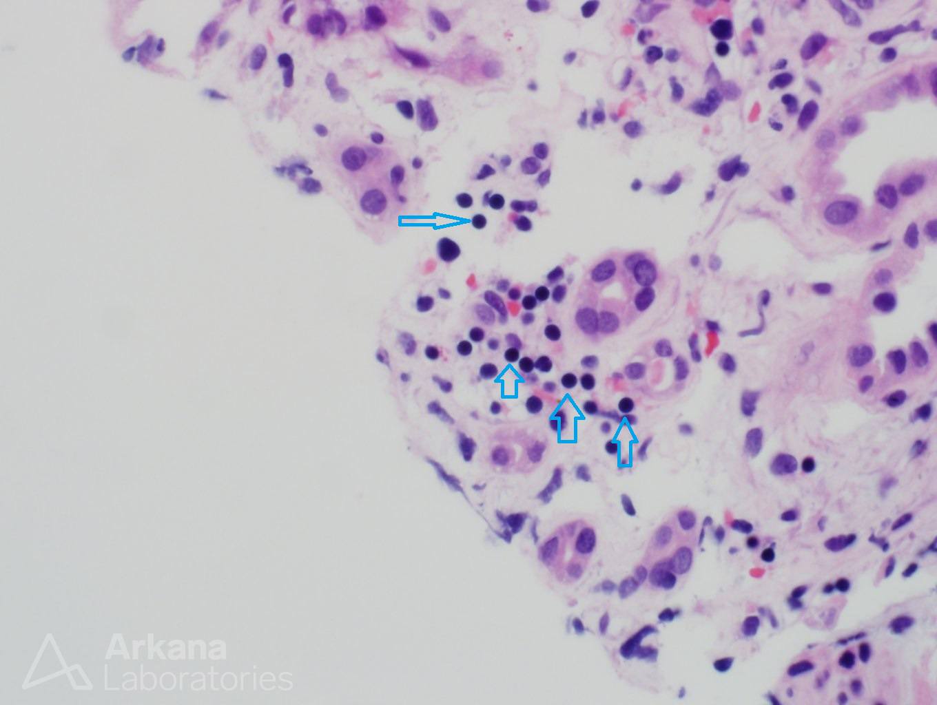 Nucleated Red Blood Cells in Circulation