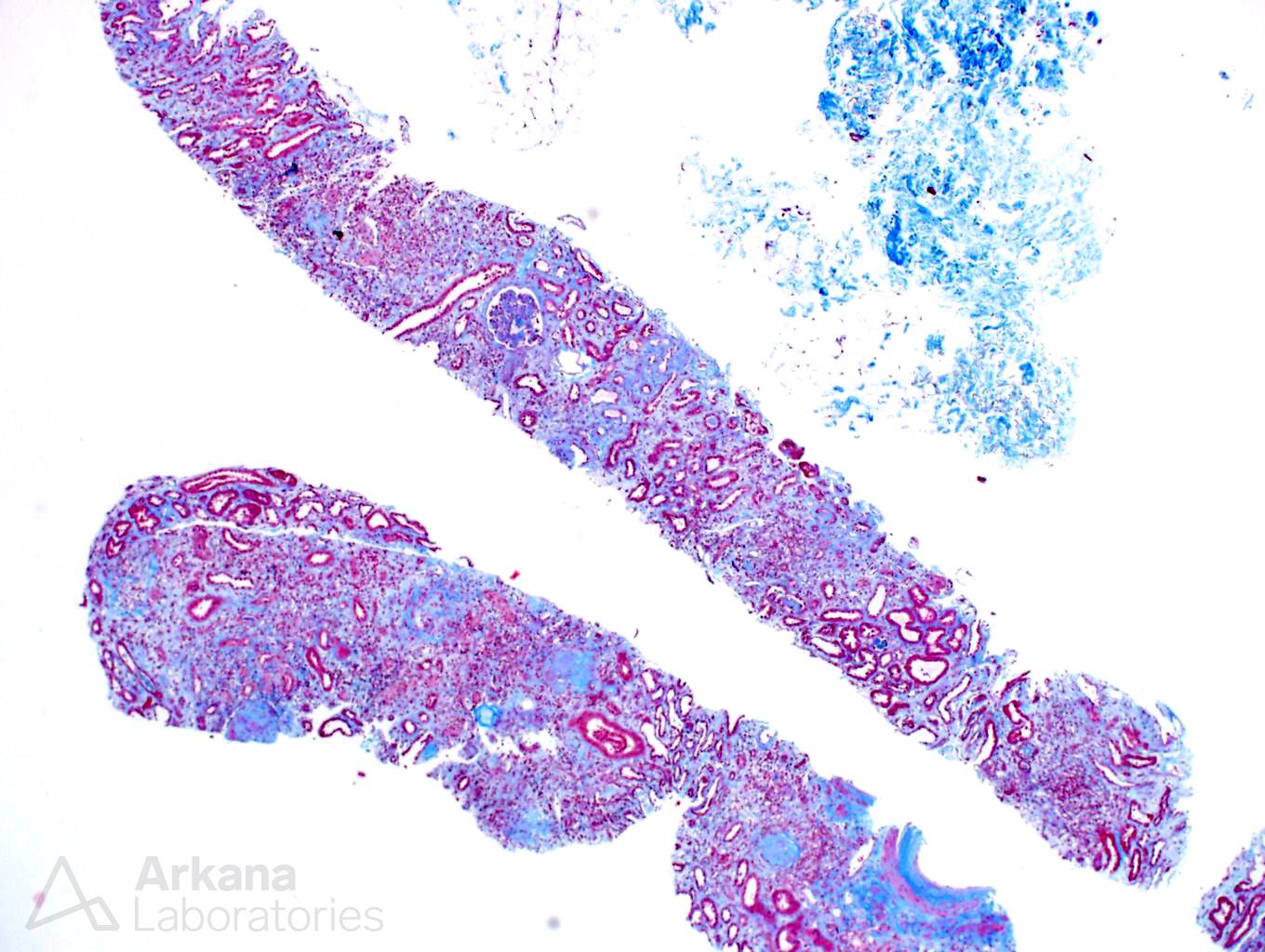 Nucleated Red Blood Cells in Circulation