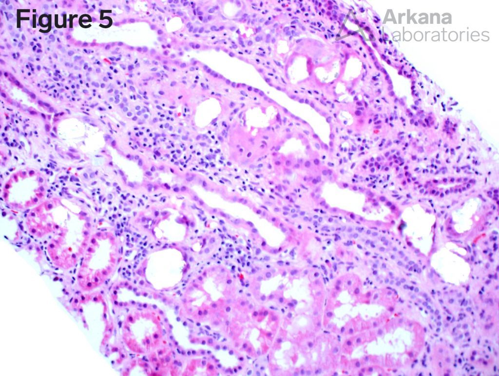 Kidney pathology stains at Arkana Laboratories