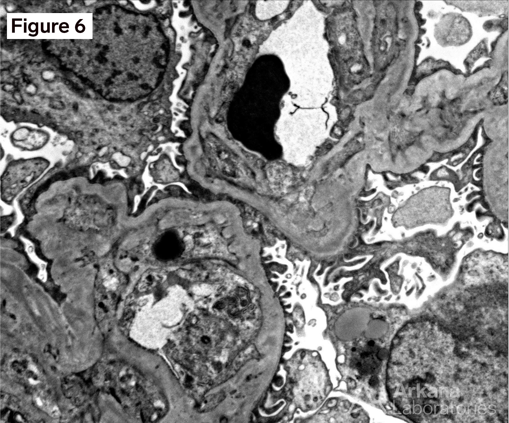 VEGF Inhibitor