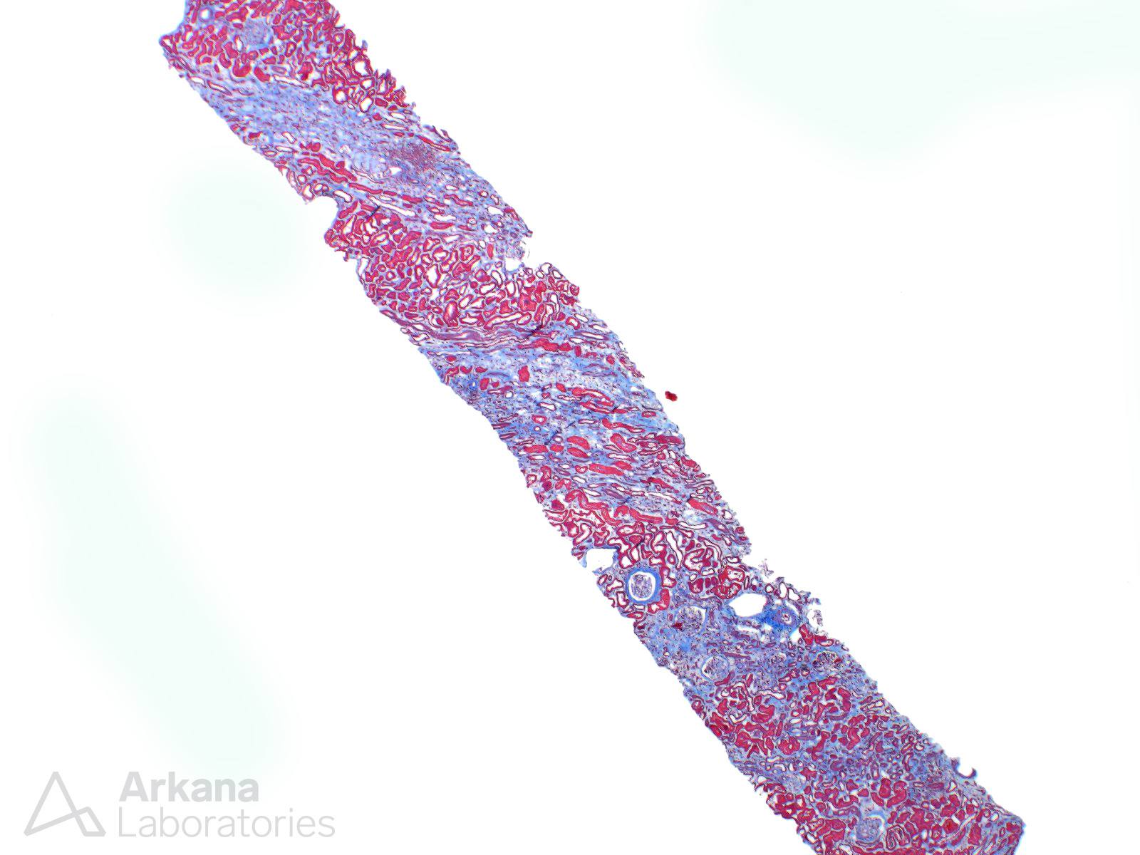 renal cortex from biopsy