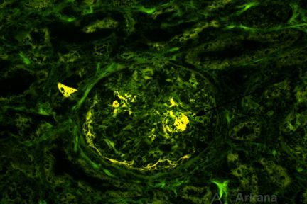 fluorescence microscopy