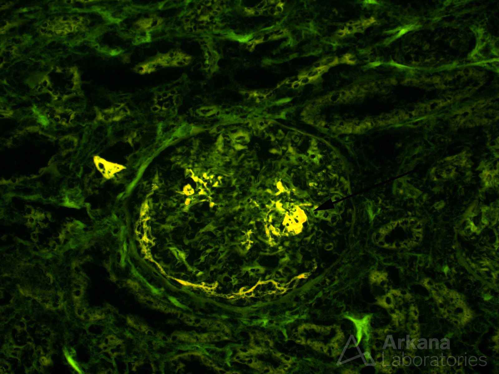 fluorescence microscopy