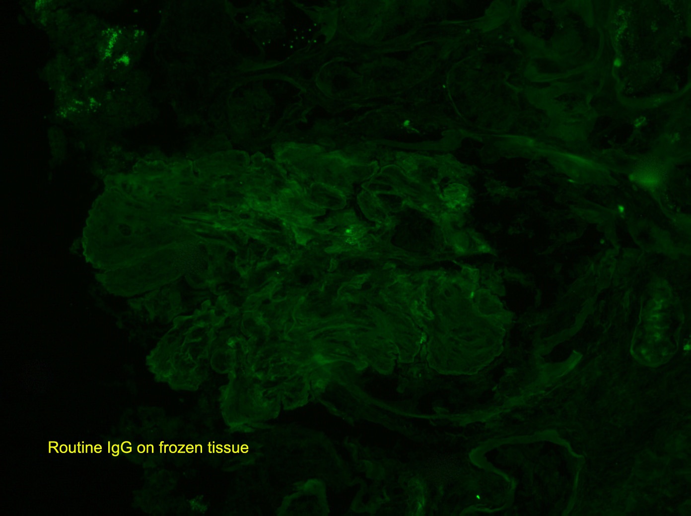 IgG on frozen renal tissue