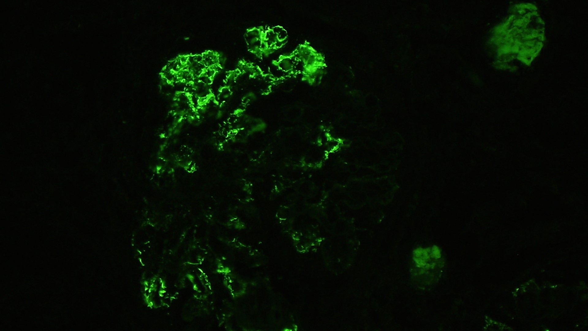 positive staining only for IgG1 and kappa light chai