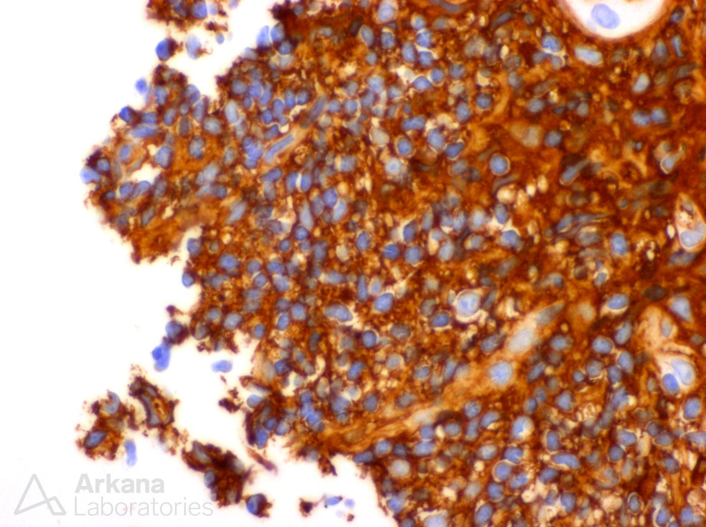 IgG4-Positive Plasma Cells