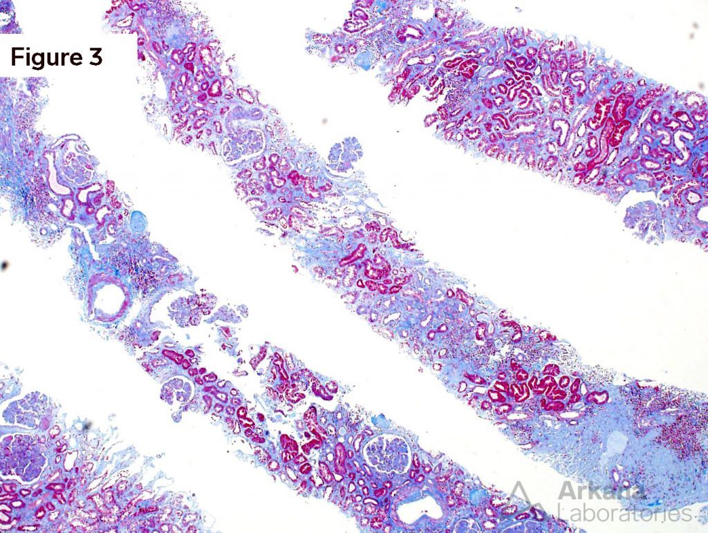 LM, EM, IF, Arkana Laboratories