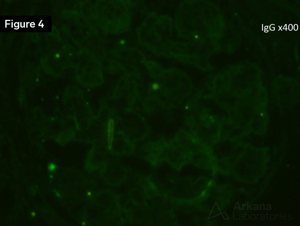 IgG Stain, Arkana Laboratories