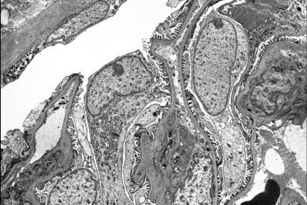 normal glomerulus