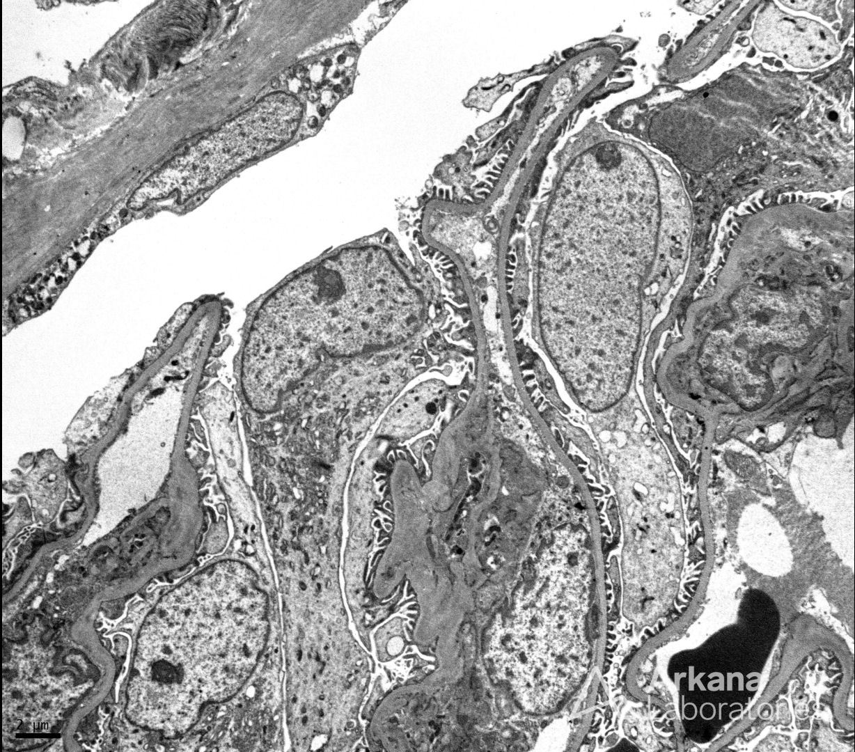 normal glomerulus