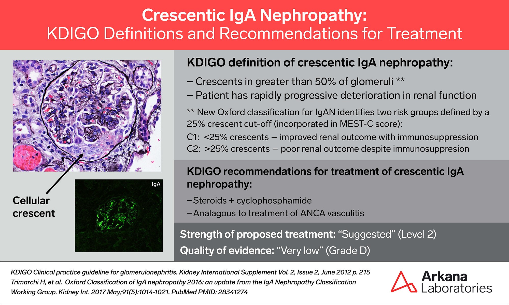 crescentic IgA nephropathy, KDIGO Connections, arkana laboratories, renal pathology, kidney pathology, nephropathology