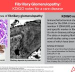KDIGO Connections: Fibrillary Glomerulopathy
