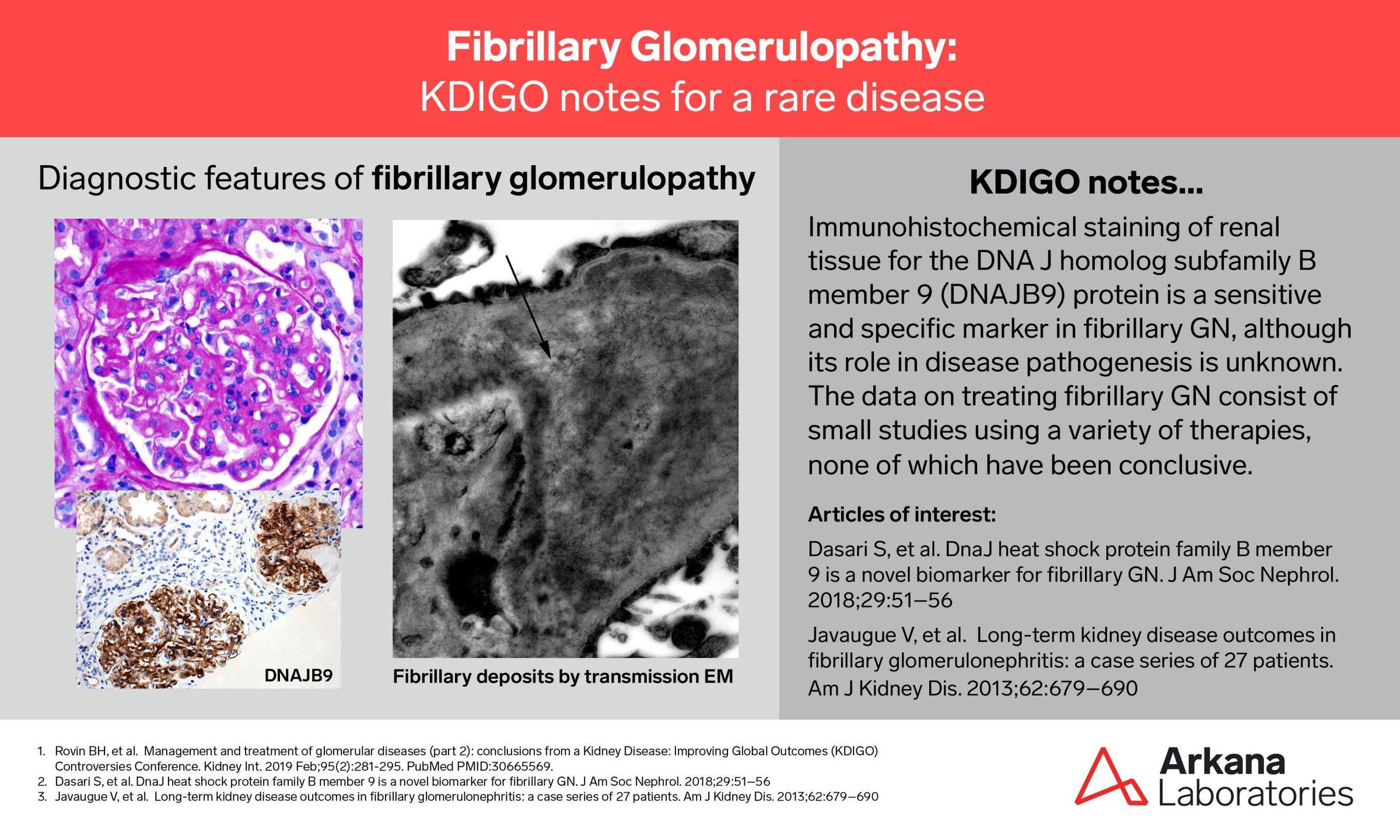 Fibrillary Glomerulopathy, KDIGO connections, Arkana Laboratories