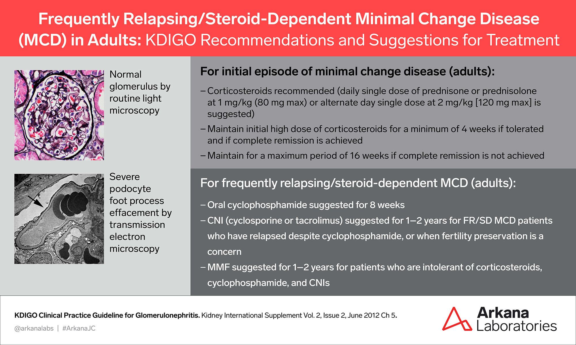 Minimal Change Disease, KDIGO Connections, Arkana Laboratories, renal pathology, nephropathology, Relapsing/Steroid-Dependent Minimal Change Disease