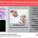 KDIGO Connections: PLA2R-Positive Membranous Glomerulonephritis