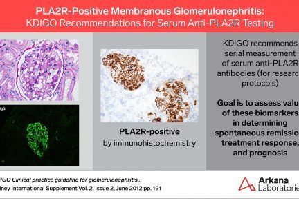 PLA2R-Positive Membranous Glomerulonephritis, PLA2R, KDIGO Connections, Arkana Laboratories
