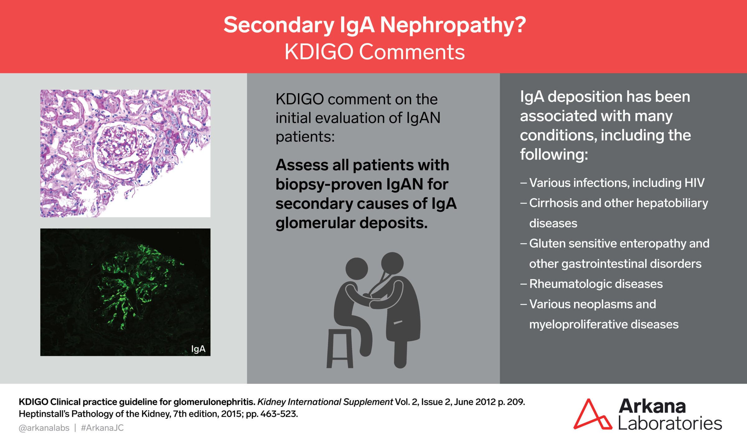 Secondary IgA Nephropathy