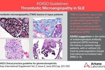 SLE and TMA, KDIGO Connections, Arkana Laboratories, pathology, renal disease