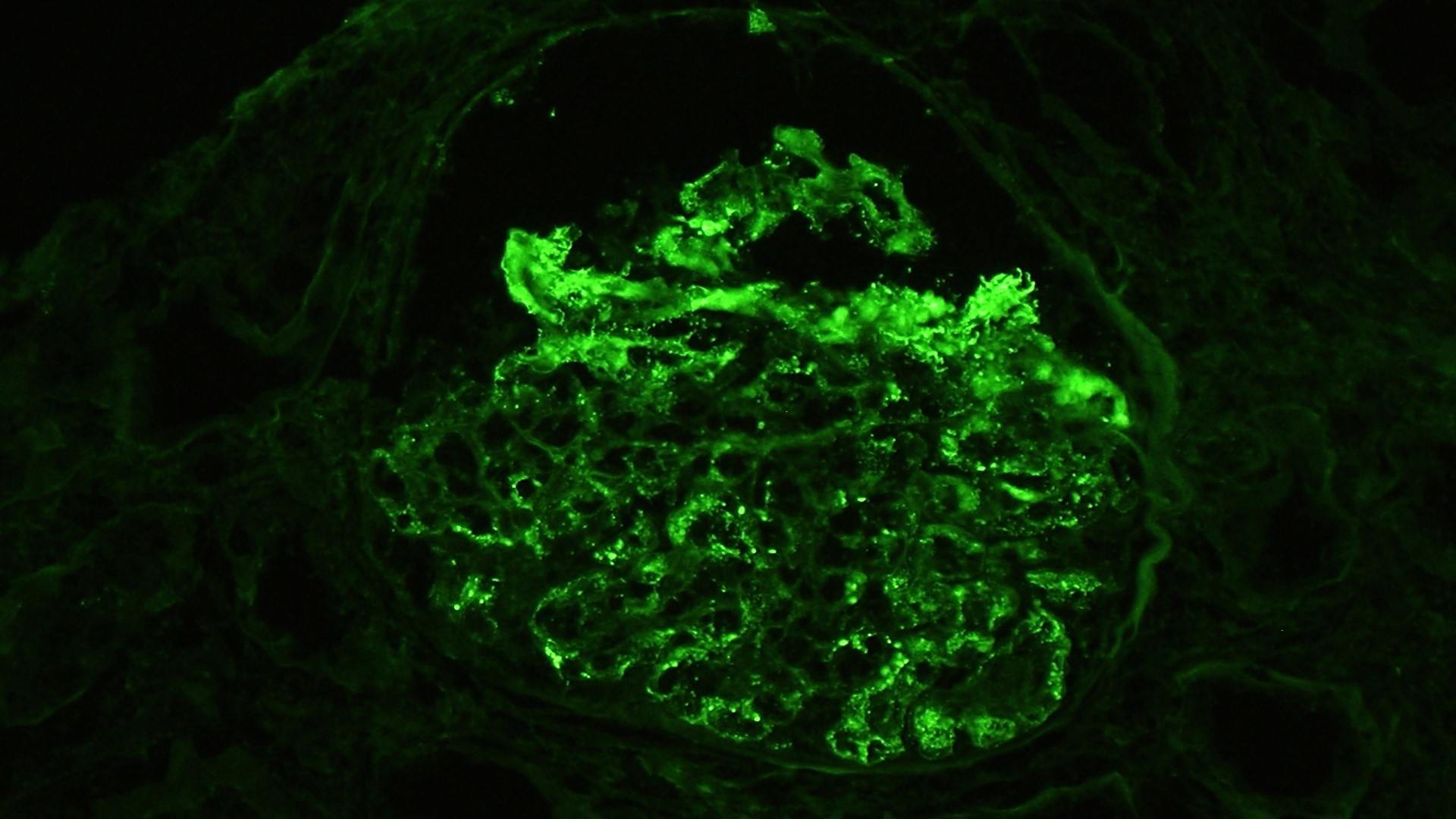 positive staining only for IgG1 and kappa light chai