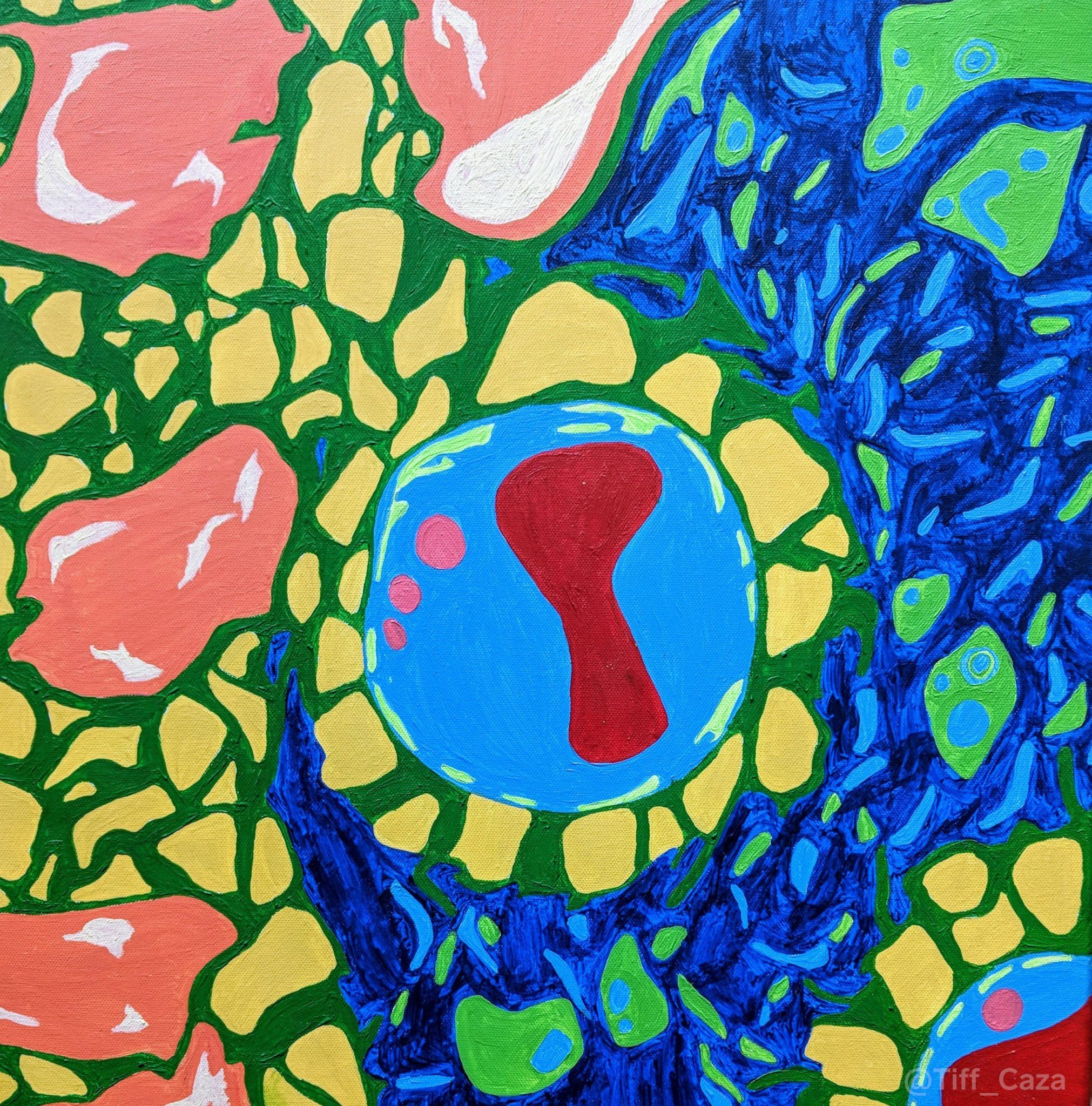 Membranous Lupus Nephritis | Art of Medicine | Arkana Labs