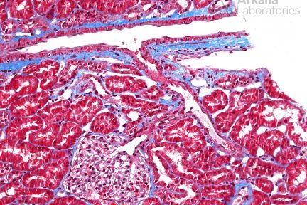 normal renal tissue, renal cortex, arkana laboratories, kidney biopsy