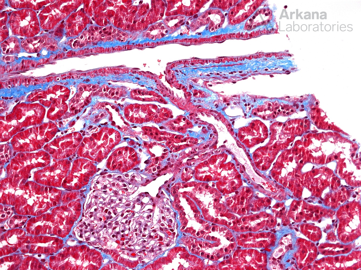 normal renal tissue, renal cortex, arkana laboratories, kidney biopsy