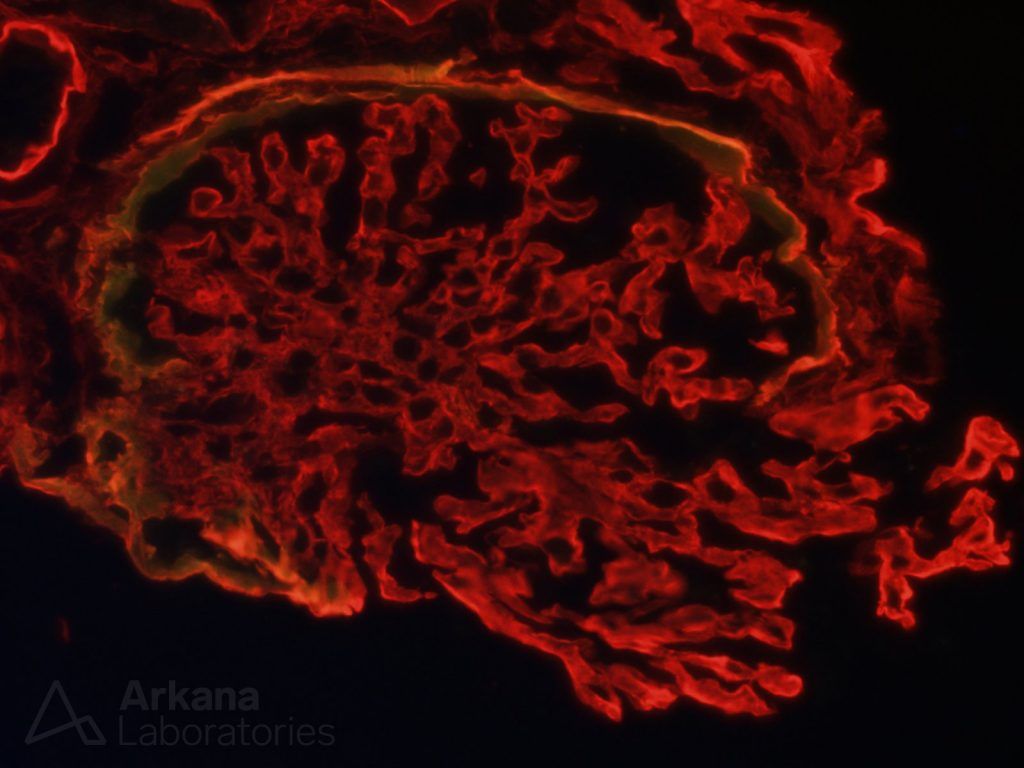 renal pathology stain at arkana laboratories