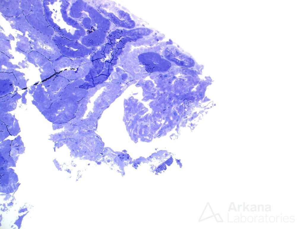 immunofluorescence, glomerulus, pathology stain