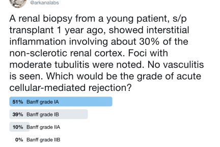 acute T-cell mediated rejection