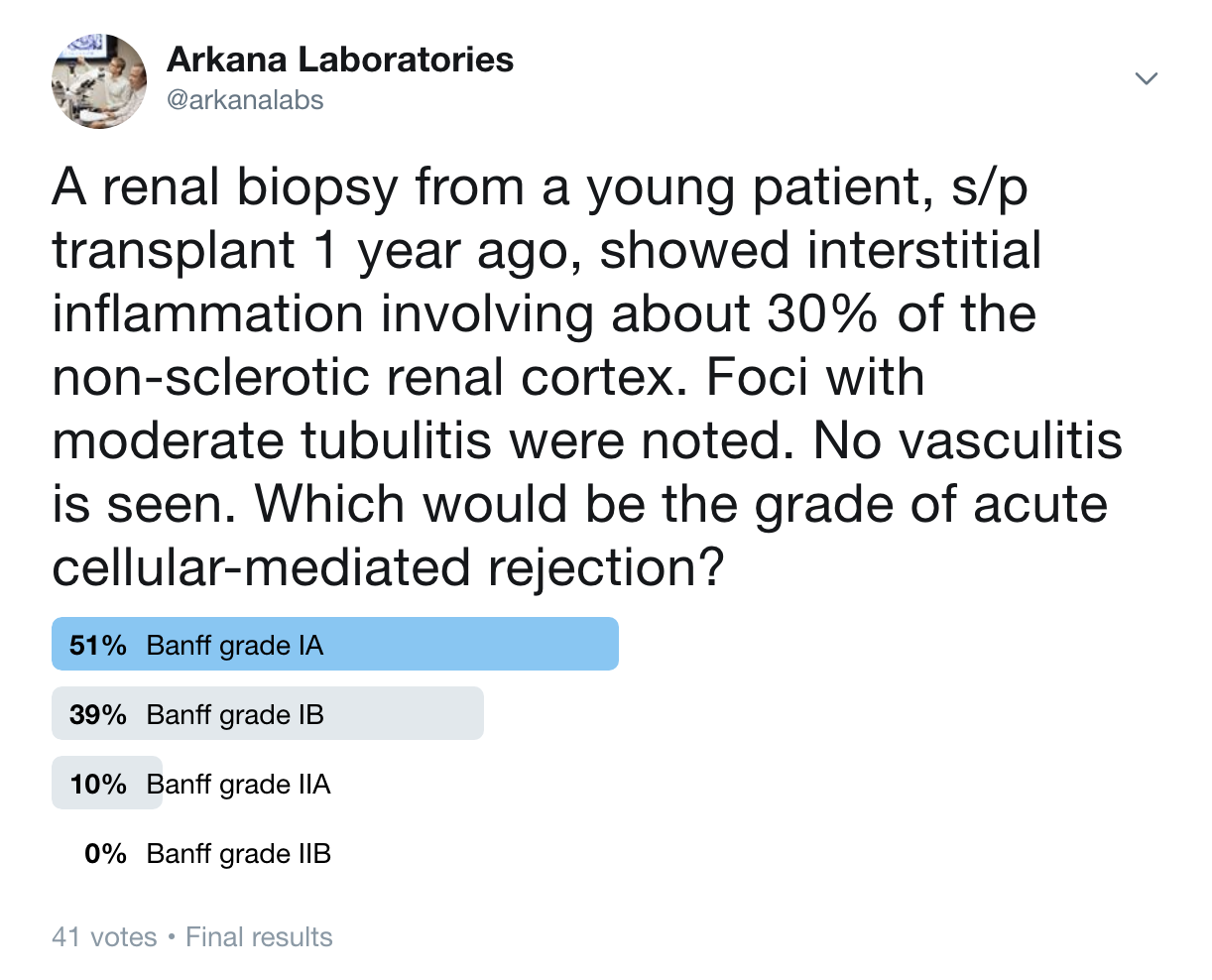 acute T-cell mediated rejection