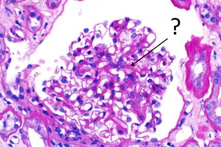 DNAJB9 Uncovers Dual Pathology