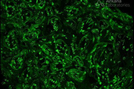 Tissue Antinuclear Antibodies