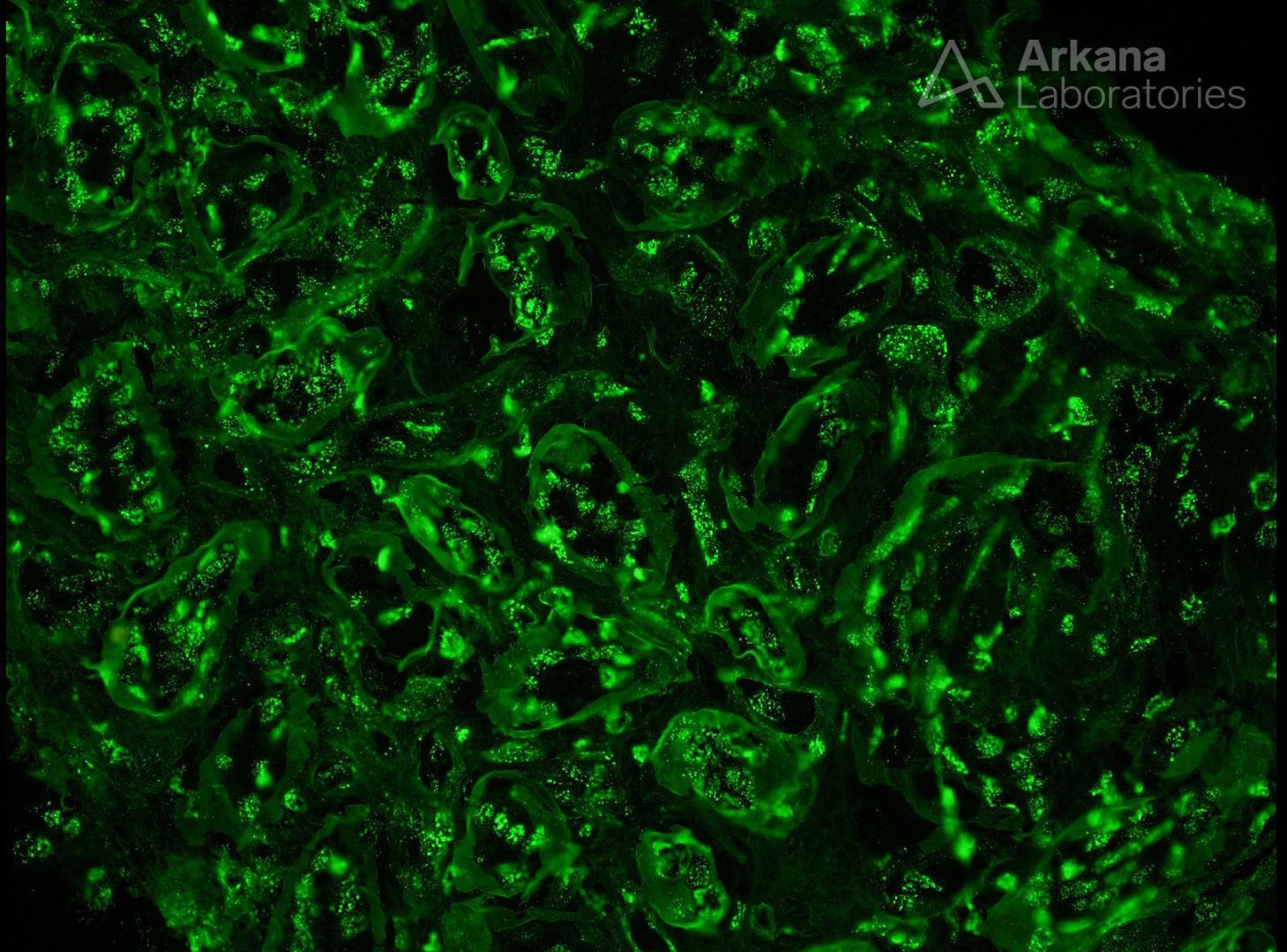 Tissue Antinuclear Antibodies