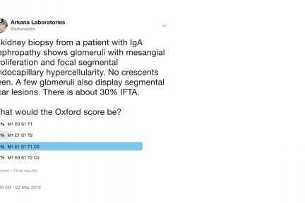 IgA nephropathy, Twitter Poll, Arkana Laboratories, kidney pathology, renal disease