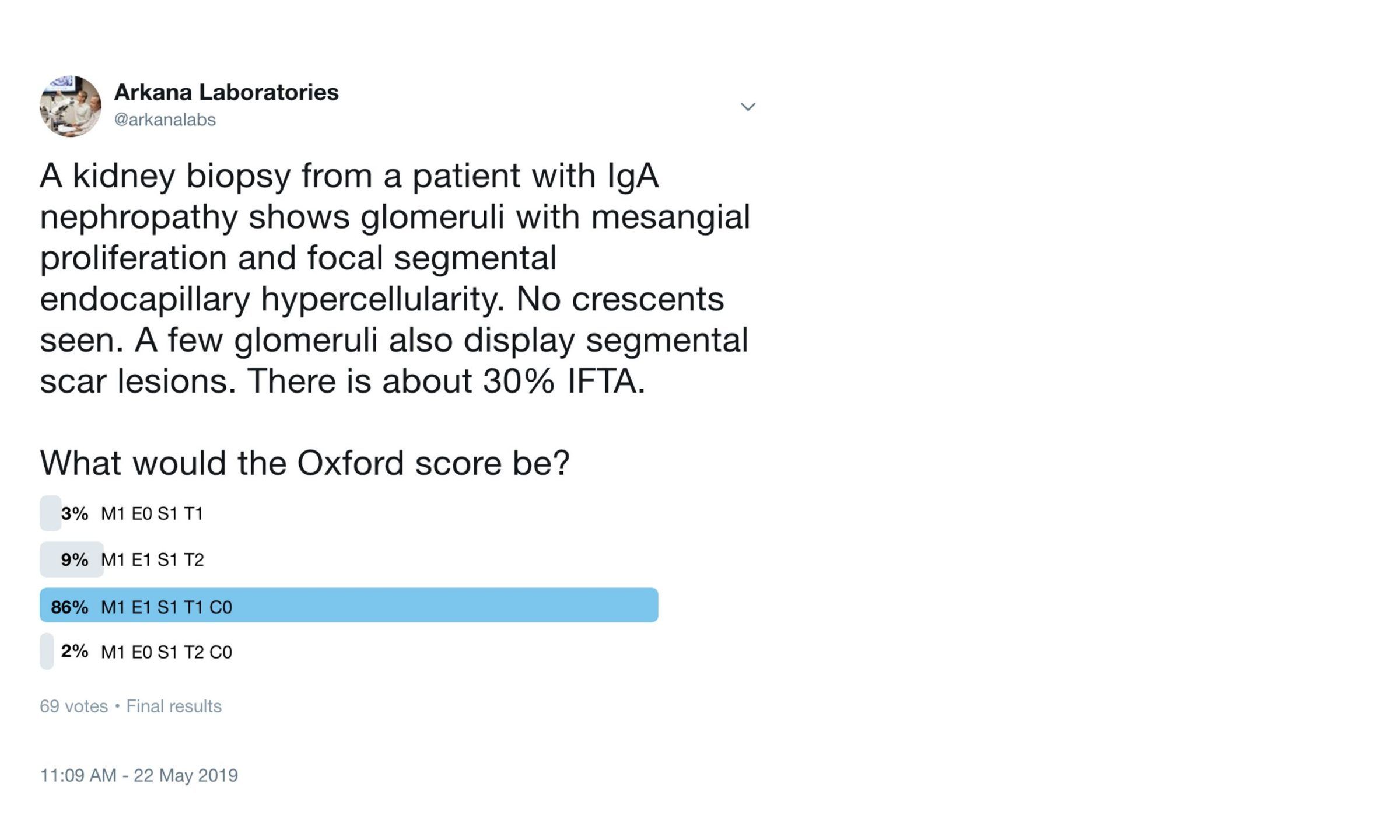 IgA nephropathy, Twitter Poll, Arkana Laboratories, kidney pathology, renal disease