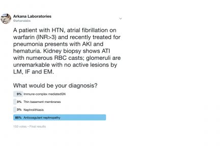 anticoagulant nephropathy, Arkana Laboratories, renal pathology, kidney biopsy