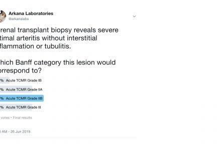 TCMR, arkana laboratories, renal pathology, kidney biopsy