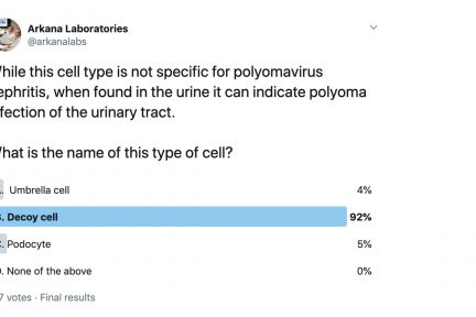 Decoy cells, arkana laboratories, renal pathology