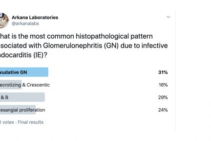 necrotizing and crescentic gn, crescentic GN, Glomerulonephritis, Twitter Poll, Arkana Laboratories