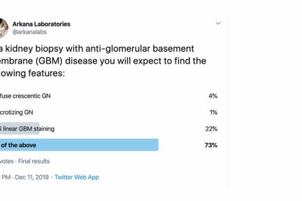 Anti-GBM disease, twitter poll, arkana laboratories
