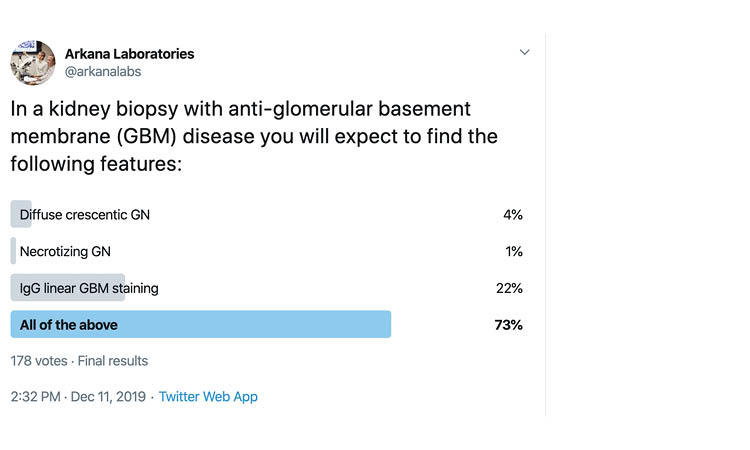 Anti-GBM disease, twitter poll, arkana laboratories