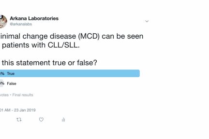 CLL/SLL Patients, arkana laboratories,