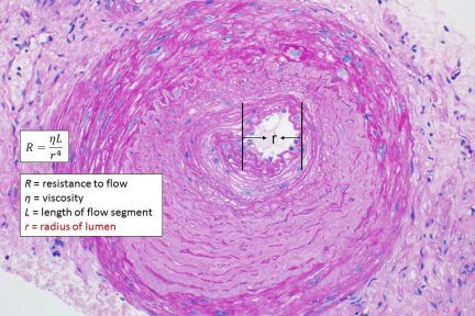 Vascular Resistance