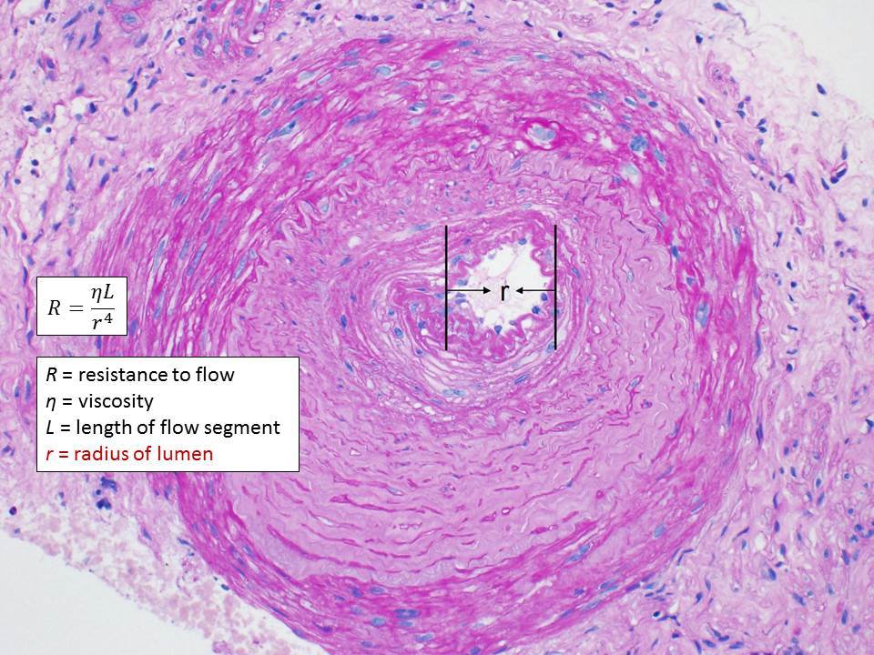 Vascular Resistance