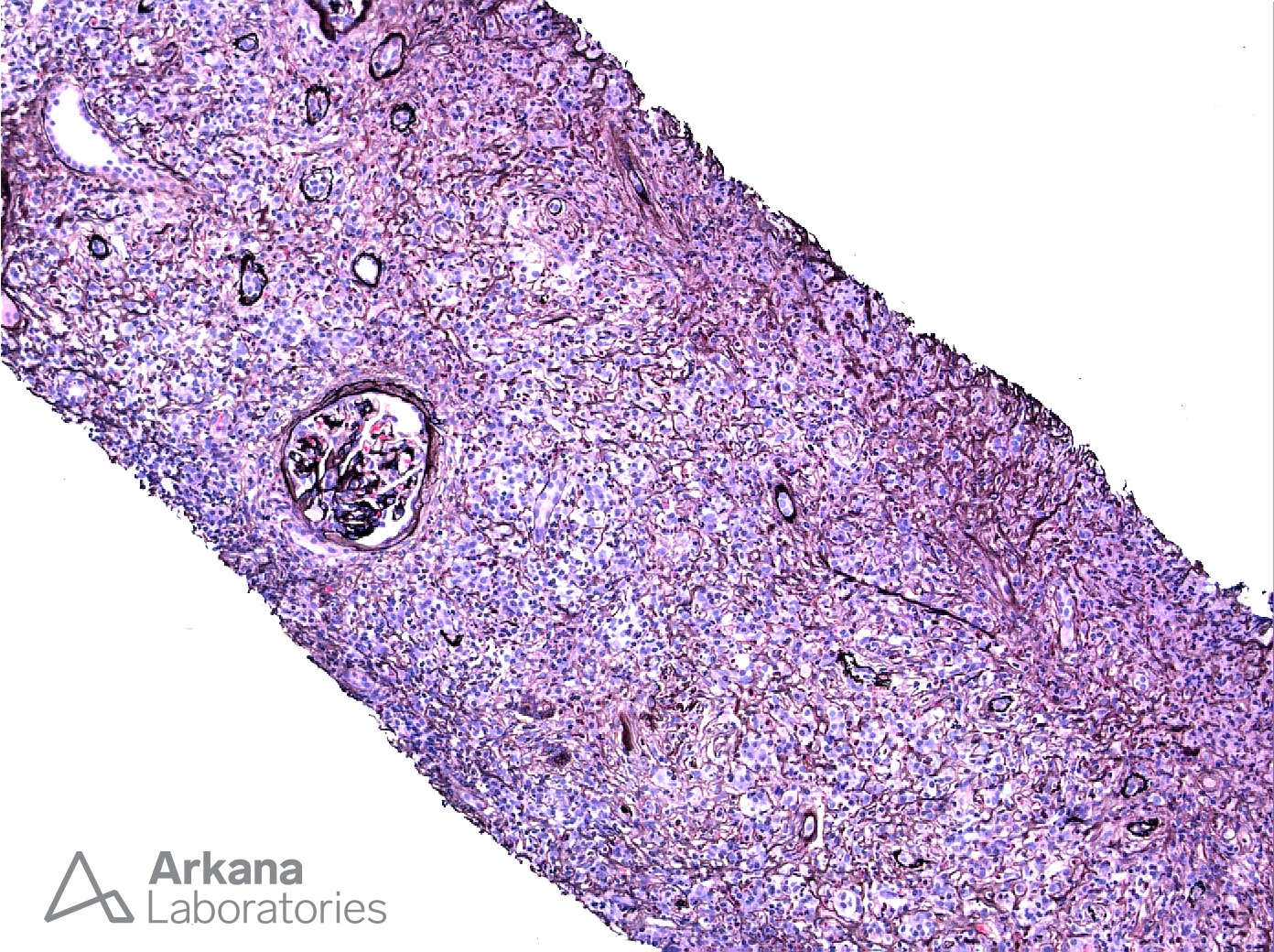 IgG4-Positive Plasma Cells